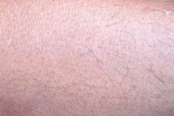 istock dry and dehydrated human skin texture background 2212656139