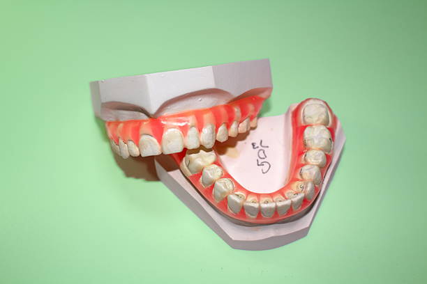 Plaster dental model, dental image, orthodontic model