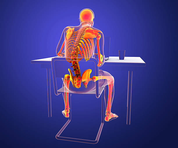 istock Working with laptop in a wrong position leading to back pain, artwork 2212888094
