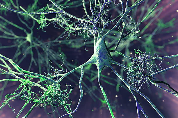 istock Nerve cells affected by Alzheimer's disease, illustration 2212890390