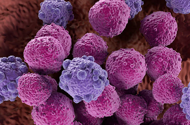 Lymphoma cells - isometric view 3d illustration stock photo