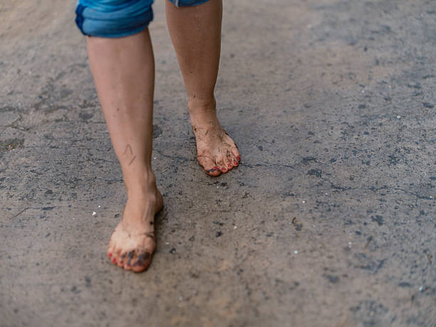 Close-up of a person's bare feet walking on a dusty, unpaved surface. One foot appears clean while the other is covered with dirt and mud, showing the contrast between protected and exposed skin against the rough textured ground.