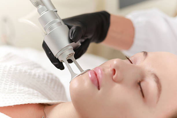 istock CO2  carbon dioxide laser resurfacing cosmetology  procedure 2215194937