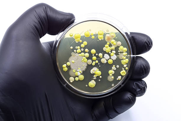 istock Microbiological culture plate with bacterial colonies. Super bacteria. Antibiotics. 2215299949