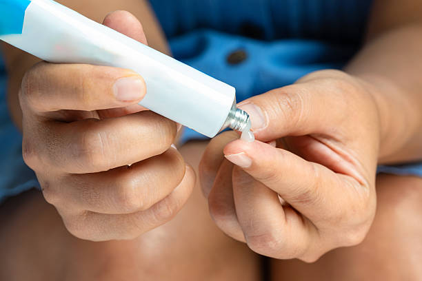 istock The woman's hand, she uses steroids Apply External type 2215337974