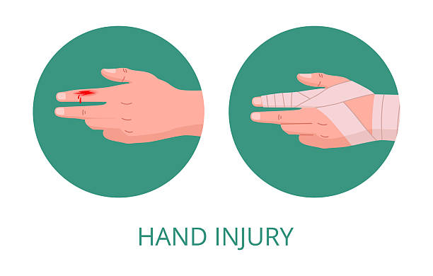 istock Injured human hand. Bandaged damaged arm, emergency treatment for skin cut flat vector illustration. Physical injury bandage 2215635522