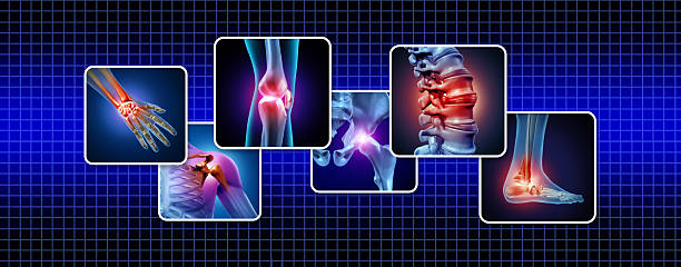 istock Human Joints Pain 2215945492