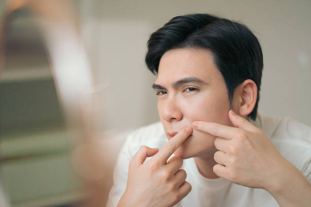 istock Man Inspecting Skin by Squeezing Acne While Looking at His Face in Mirror 2216014031