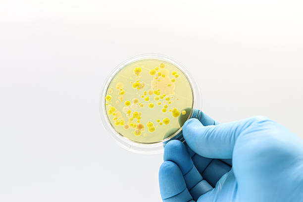 istock Bacteria. Doctor's or scientist's hand with a microbiological culture dish with colonies of microorganisms 2216138149