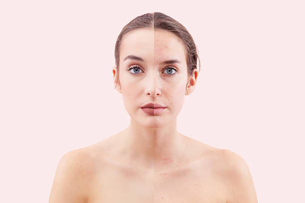istock Young woman before and after makeup face comparison 2216649657