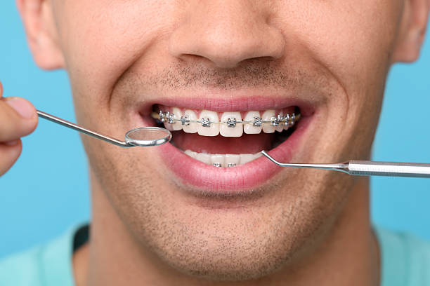 istock Examination of man's teeth with braces using dental tools on light blue background, closeup 2216695919