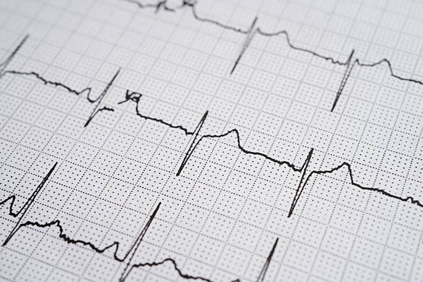 istock Electrocardiogram (ECG), heart wave, heart attack, cardiogram report. 2216806498