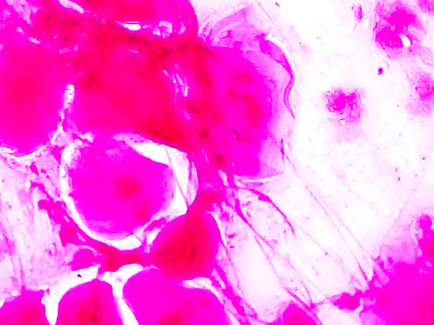 istock Gram-negative intracellular diplococci, gram stain microscopic view. 2216928659