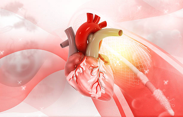 istock Human heart with stent implantation concept 2217099049