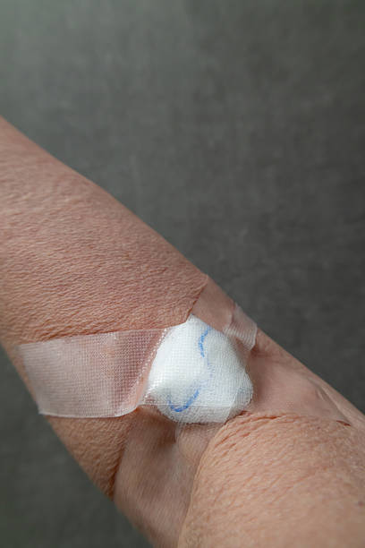 istock Arm with bandage after blood draw 2217099320