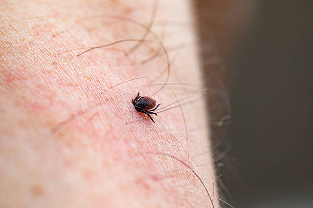 istock Close-up of Deer Tick on Hand 2217313047