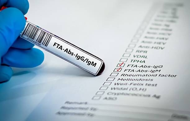 Blood sample tube and paper order request for FTA-Abs test analysis.