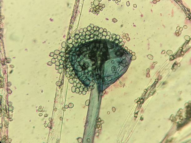 istock Microscopic view of Mucorales with conidia. 2217761032
