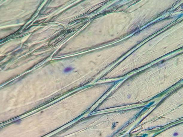 istock Microscopic view of fibrous tissue strands. 2217761075