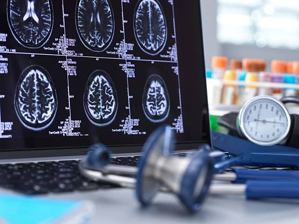 istock A laptop displays brain scans, with a stethoscope and medical instruments on the table. 2217839610