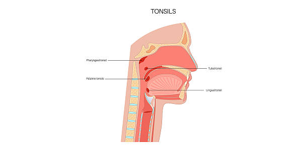 Tonsils anatomical poster Tonsils anatomical medical poster. Oval shaped masses of lymphoid tissue located at the back of the human throat. Traps germs entering through the mouth or nose medical flat vector illustration. vocal cords stock illustrations