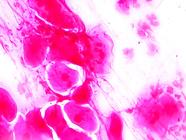 istock Gram-negative intracellular diplococci, gram stain microscopic view. 2218099772