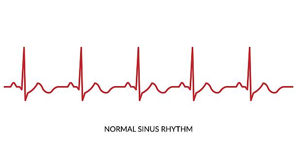 illustrations, cliparts, dessins animés et icônes de ligne de battement de cœur ecg. illustration vectorielle d’électrocardiogramme. rythme sinusal normal - rythme cardiaque