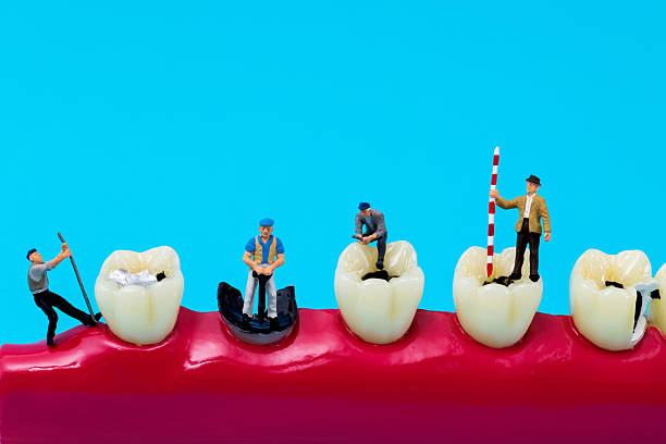 Miniature people filling teeth model on blue background.