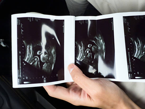 istock A woman's hand holds an X-ray film. 2218599186