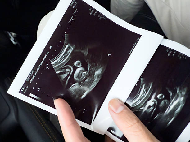 istock A woman's hand holds an X-ray film. 2218599194