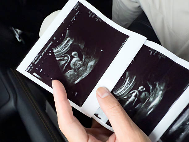 istock A woman's hand holds an X-ray film. 2218599195