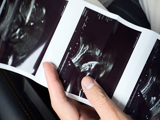 istock A woman's hand holds an X-ray film. 2218599203