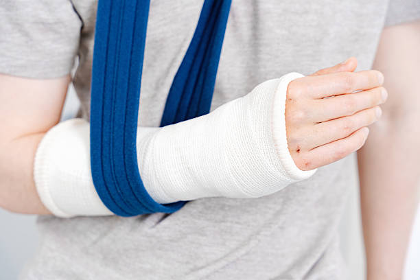 istock Broken Arm in White Cast and Blue Sling 2218961985