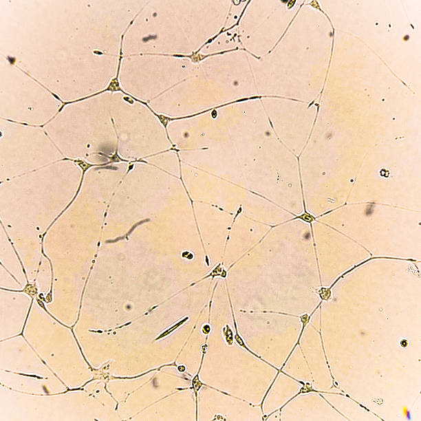 istock Human glioma cells. 2219128045