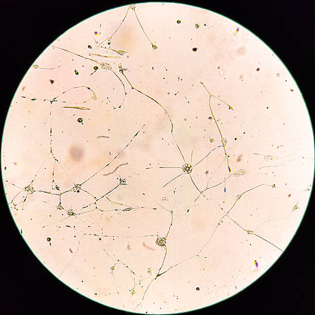 istock Human glioma cells. 2219128054