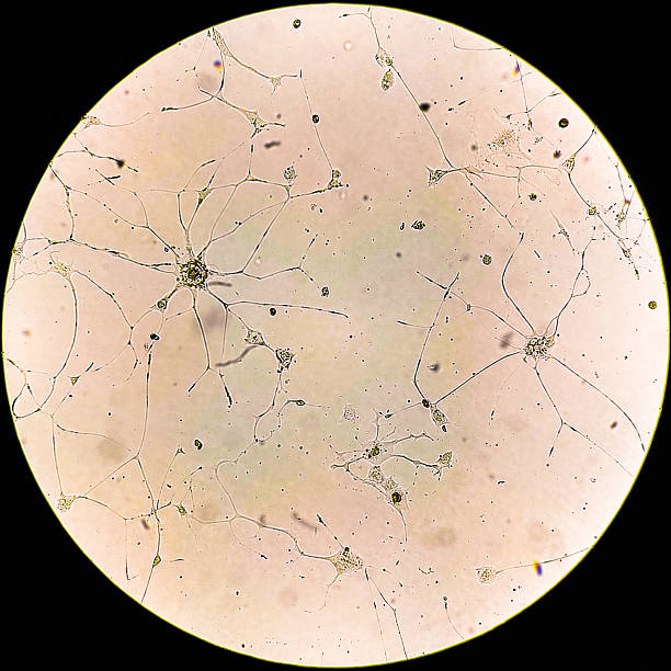 istock Human glioma cells. 2219128091