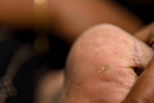 istock Close-up of a leg with a visible scar 2219251429