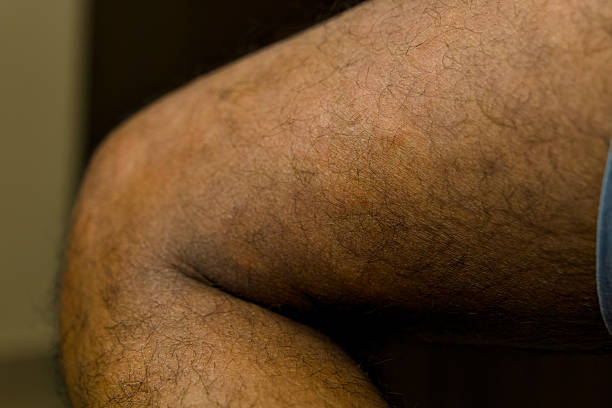 istock Close-up view of a man's knee with visible hair 2219251682