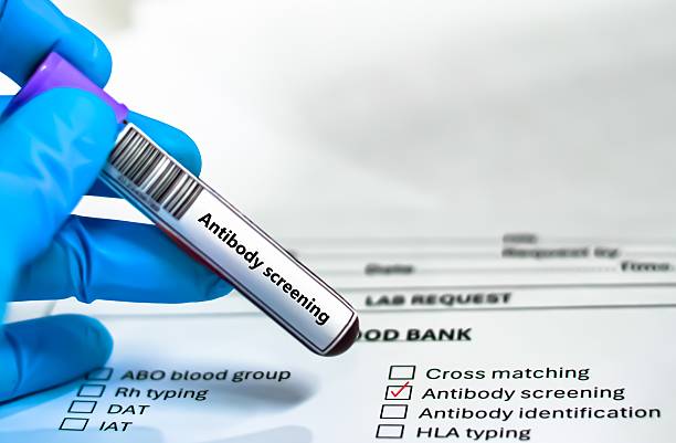 istock Blood sample tube 2219292858