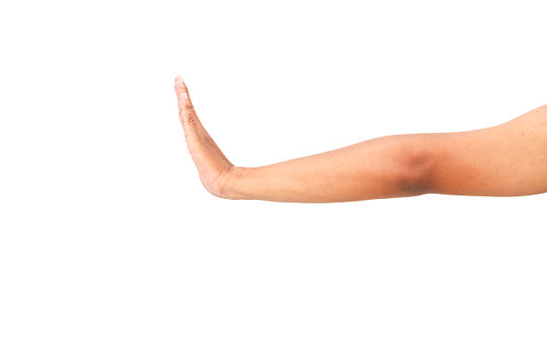 Outstretched arm with hand as a sign of stop