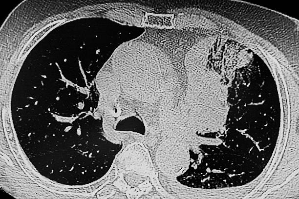 istock X- Ray image of cholangiopancreatography. 2220129717