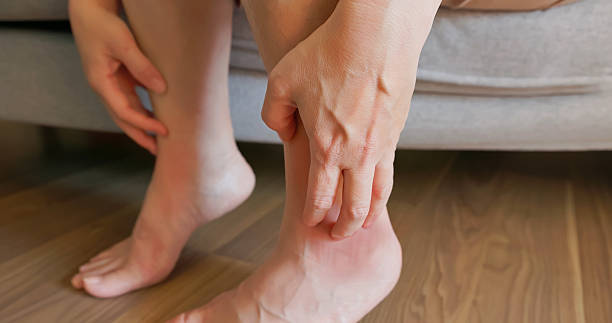 istock itchy leg skin scratch 2220254627