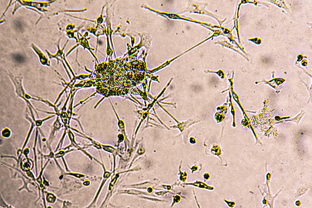 istock Glioblastoma cell culture. 2220293423