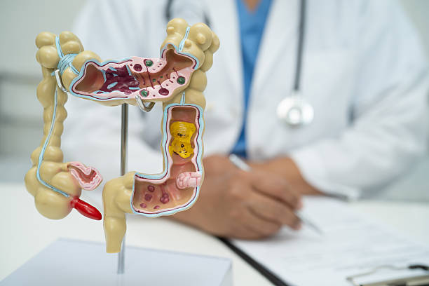 istock Intestine, appendix and digestive system, doctor holding anatomy model for study diagnosis and treatment in hospital. 2220575580
