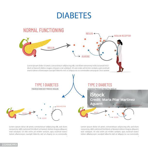 Insulin Normal Pattern Doctor Explaining Diabetes Type 1 And Type 2 Normal Functioning And ...