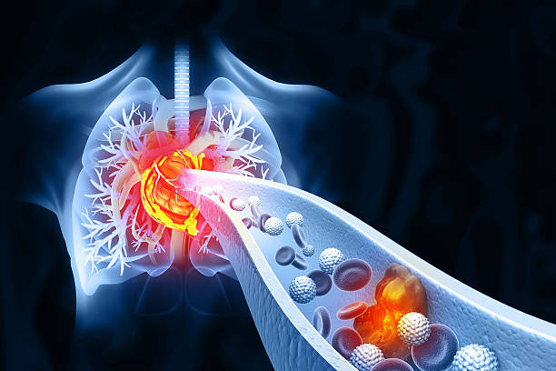 istock Cholesterol blocked artery with heart. 3d illustration 2220891223