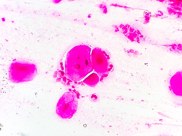 istock Gram-negative intracellular diplococci, gram stain microscopic view. 2220911345