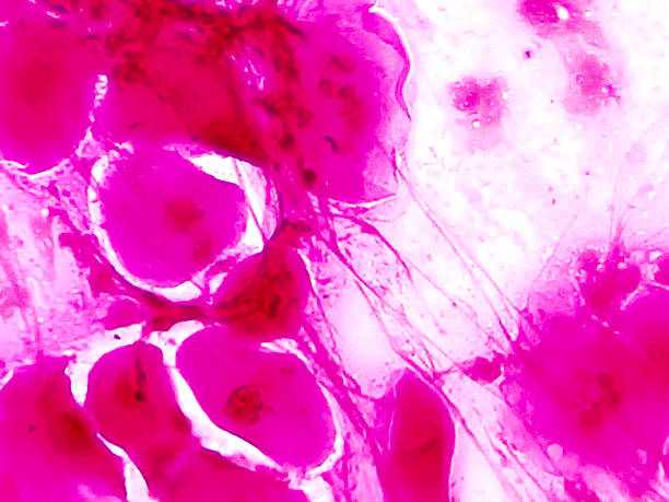 istock Gram-negative intracellular diplococci, gram stain microscopic view. 2220911350