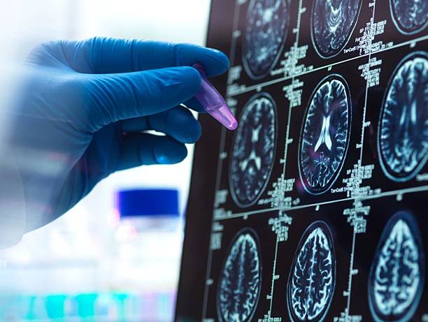 istock Brain scan image with a doctor's hand, representing medical diagnosis and research. 2221046595
