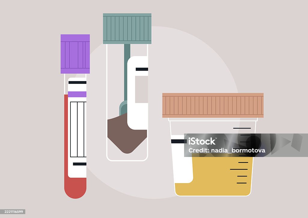 Three Distinct Lab Test Samples Depict Different Collection Methods ...
